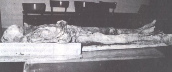La mummia di Torricella